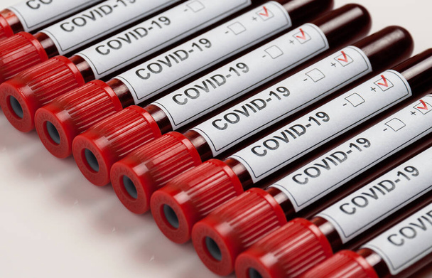 Amerika 'da koronavirüs salgını - Fotoğraf, Görsel