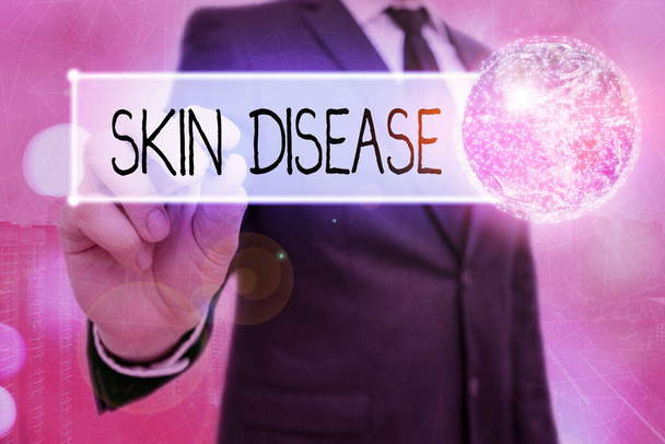 Λέξεις που γράφουν ασθένεια του δέρματος. Επιχειρηματική έννοια για οποιαδήποτε από τις ασθένειες ή διαταραχές που επηρεάζουν το ανθρώπινο δέρμα Στοιχεία αυτής της εικόνας που παρέχεται από τη Nasa. - Φωτογραφία, εικόνα