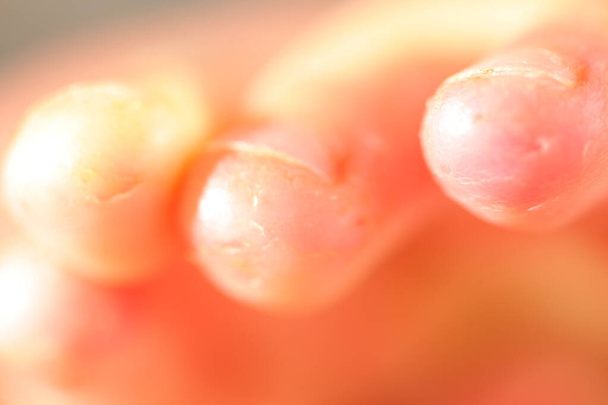 Onychophagia. pokousané nehty v dítěti. - Fotografie, Obrázek