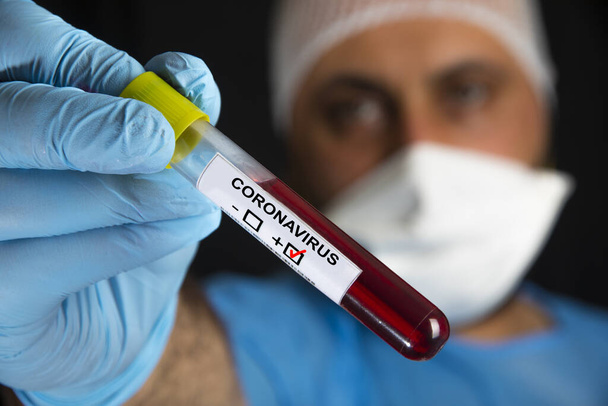 Blood sample tube positive with label COVID-19 or novel coronavirus - Фото, изображение