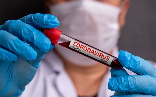 呼吸器マスクを着用した看護師は、コロナウイルスの陽性の血液検査結果を保持 - 写真・画像