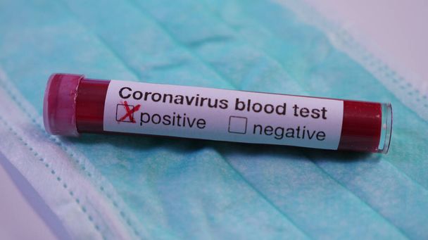 Coronavirus blood test on green medical mask, close up. Concept: COVID-2019 virus protection, Stop spreading virus, coronavirus outbreak - Fotoğraf, Görsel