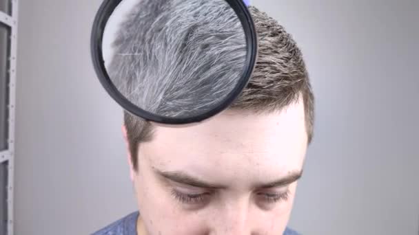 Trycholog bada siwe włosy młodego mężczyzny pod szkłem powiększającym. Wcześniejsze wybielanie włosów i pigmentu jako oznaka niskiej melaniny w ciele faceta - Materiał filmowy, wideo