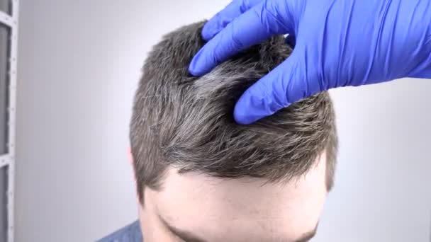 Doktor trycholog w niebieskich rękawiczkach bada siwe włosy młodego mężczyzny. Koncepcja wczesnego siwienia włosów u młodych ludzi. - Materiał filmowy, wideo