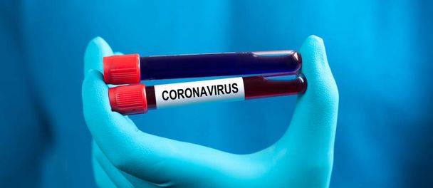 Corona virüsü salgını. Salgın Virüsü Solunum Sendromu. - Fotoğraf, Görsel