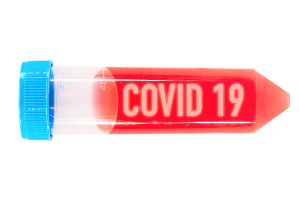 陽性のCOVID 19血液サンプル - 写真・画像