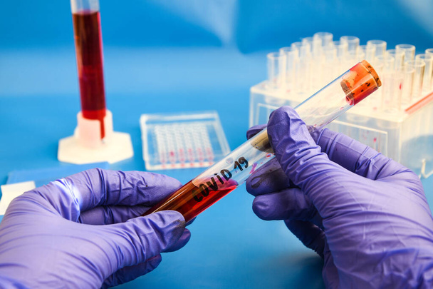 Échantillon de sang de coronavirus, test ADN du sang en laboratoire et tubes et seringue de prélèvement d'échantillons de sang avec interface ADN fond bleu moderne, virus covid-19
 - Photo, image