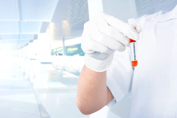Doctor man in protective gloves holding a test tube with a coronavirus blood sample. Prevent flu disease Coronavirus - Φωτογραφία, εικόνα