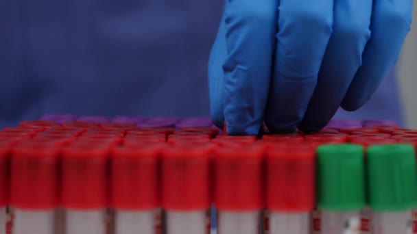 Onderzoeker houdt bloed in reageerbuis voor het controleren van covid-19 in het lab - Video
