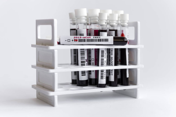 白い背景のラックにコロナウイルス血液検査室の試験管のグループ - 写真・画像