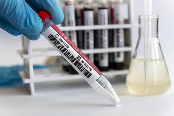 Χέρι με σπάτουλα Coronavirus αρνητική δοκιμή και το αίμα γυάλινους σωλήνες δοκιμές στο παρασκήνιο σε λευκό ράφι - Φωτογραφία, εικόνα