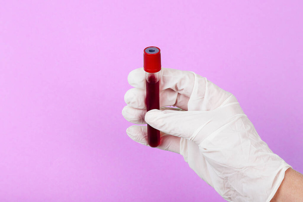 Ręczne trzymanie próbki krwi w probówce. Koncepcja koronawirusa - Zdjęcie, obraz