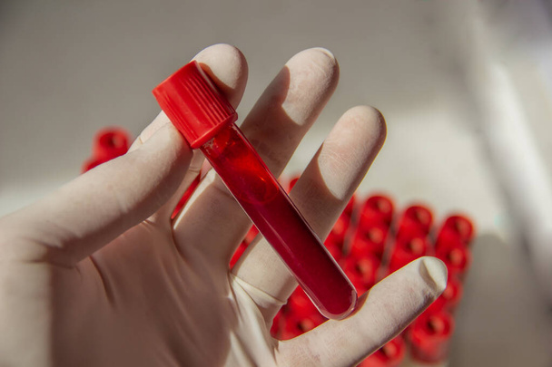 La sangre en un tubo de ensayo sostiene una mano enguantada para la investigación de varios virus
 - Foto, Imagen