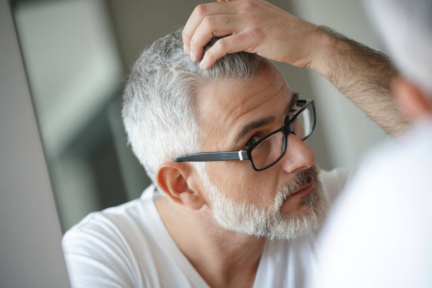 Portrait of man concerned by hair loss - Fotoğraf, Görsel