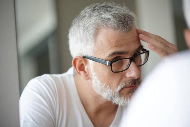 Portrait of man concerned by hair loss - Фото, зображення