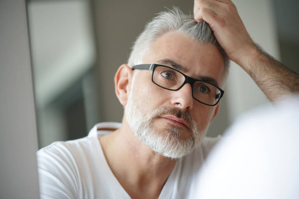 Portrait of man concerned by hair loss - Photo, Image