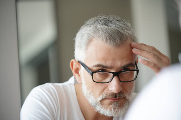 Retrato del hombre afectado por la caída del cabello
 - Foto, imagen
