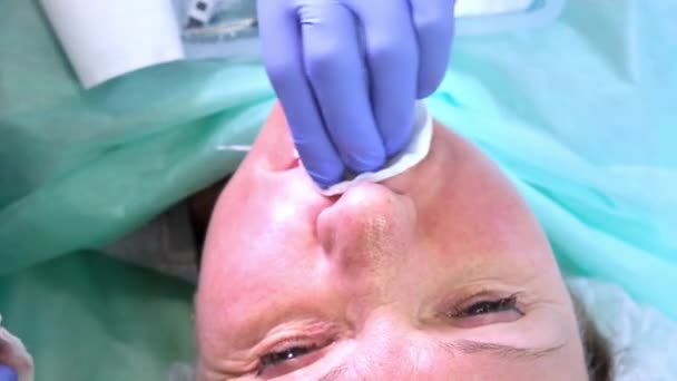 cosmetólogo médico prepara una cara de mujer para una inyección cosmética, inyecciones de ácido hialurónico. Una mujer en un salón de belleza. clínica de cirugía plástica
 - Metraje, vídeo