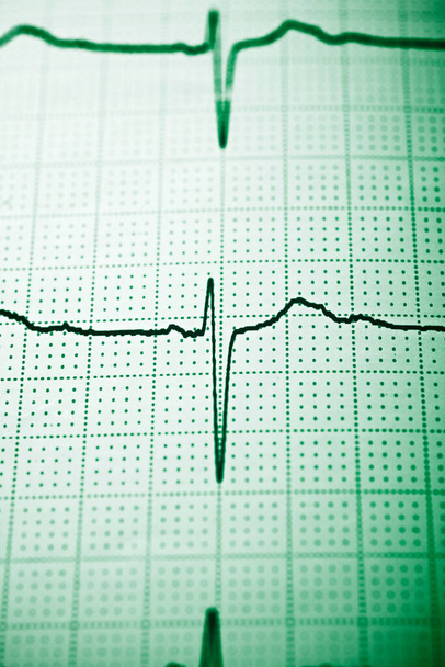 Primer plano de un electrocardiograma en forma de papel. - Foto, imagen