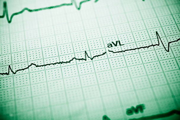 Close-up de um eletrocardiograma em forma de papel. - Foto, Imagem