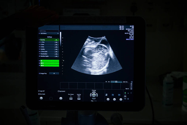 Máquina de ultrasonido médico con una imagen 4D en una sala de parto en un hospital
. - Foto, Imagen