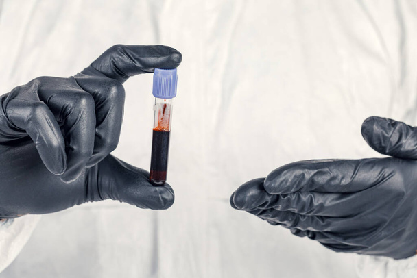 A test tube in a man's hand close-up , a man in a medical mask holding a bottle of red liquid. Concept of blood samples , medical and chemical research. - Photo, Image