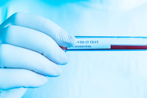 Coronavirus test in laboratory. Covid 19. Arm in plastic gloves holding test tube with test sample in laboratory. Hand detail. Blue tone filter. - Φωτογραφία, εικόνα