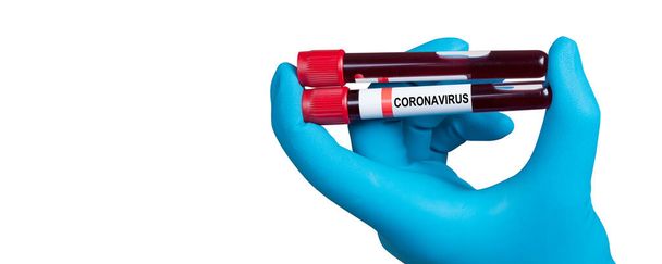 Corona virus outbreaking. Epidemic virus Respiratory Syndrome. - Photo, Image