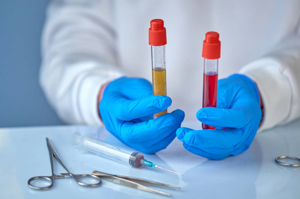 Médico segurando tubos de teste de sangue, coronavírus COVID19, HIV, SARS, antecedentes médicos de ebola, hospital, quarentena, conceito de análise
 - Foto, Imagem