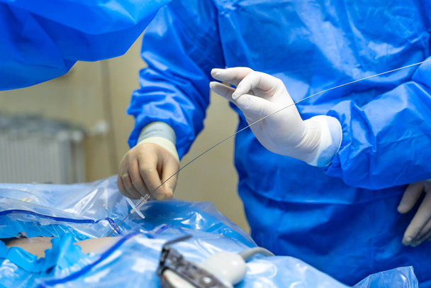 Professional doctors in medical uniform making an operation. Process of operation by neurosurgeons. Close-up. - 写真・画像