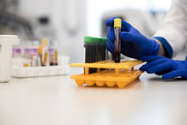 Female doctor taking blood test tube for laboratory research - Φωτογραφία, εικόνα