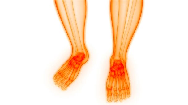 Ludzkie bóle stawów kości (stawów i kości). 3d - Ilustracja - Zdjęcie, obraz
