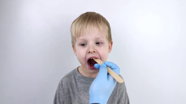 Een otolaryngoloog onderzoekt een man keel met een houten spatel. Een mogelijke diagnose is ontsteking van de keelholte, amandelen of faryngitis. Het concept van behandeling en preventie van keelziekten - Video