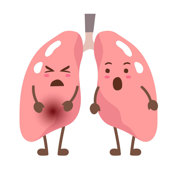 gesunde Lungen und kranke Lungen. Vektorillustration - Vektor, Bild