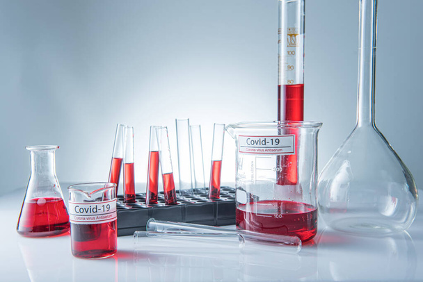 Coronavirus covid19 campione di sangue infetto nel tubo del campione sul tavolo nel laboratorio del virus della corona
 - Foto, immagini