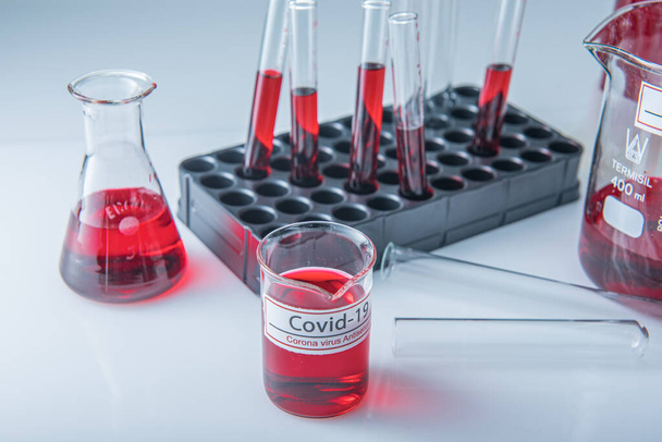 Coronavirus covid19 зараженный образец крови в пробирке на столе в лаборатории коронных вирусов
 - Фото, изображение