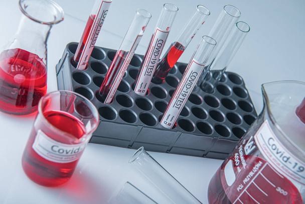Coronavirus covid19 zakażona próbka krwi w probówce na stole w laboratorium wirusa korony - Zdjęcie, obraz