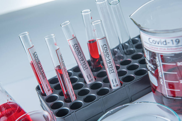 コロナウイルス検査室のテーブルの上のサンプルチューブに感染した血液サンプル19 - 写真・画像