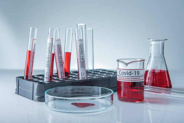 コロナウイルス検査室のテーブルの上のサンプルチューブに感染した血液サンプル19 - 写真・画像