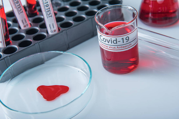 Coronavirus covid19 зараженный образец крови в пробирке на столе в лаборатории коронных вирусов
 - Фото, изображение