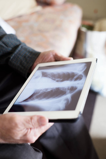 close-up de um homem caucasiano sênior observando uma radiografia de tórax em um tablet, sentado em um sofá
 - Foto, Imagem