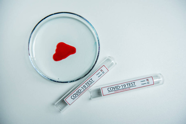 Coronavirus covid19 infected blood sample in sample tube on table in corona virus laboratory - Photo, Image