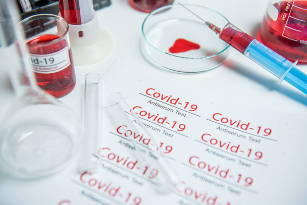 Coronavirus covid19 infizierte Blutprobe in Probenröhrchen auf dem Tisch im Coronavirus-Labor - Foto, Bild