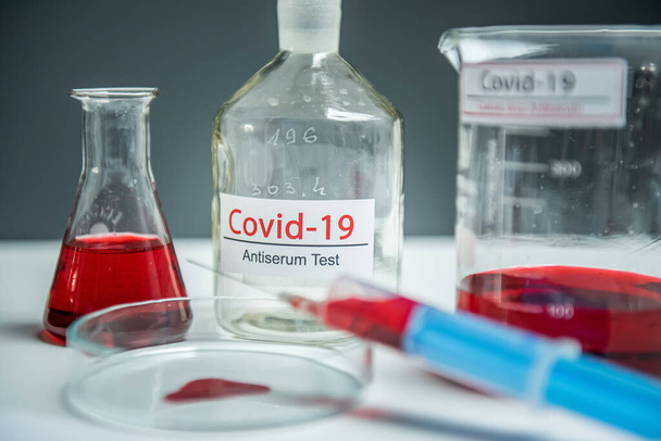Коронавірус ковід19 заражений зразком крові в пробірці на столі в лабораторії коронавірусу
 - Фото, зображення