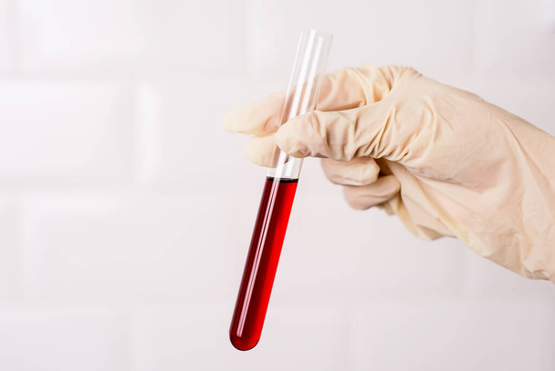 Laboratory technician holding a test tube with blood in laboratory. Detail photo  - 写真・画像