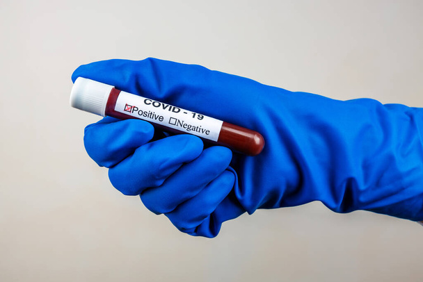 Ένα χέρι νοσοκόμου σε ένα γάντι κρατά ένα δοκιμαστικό σωλήνα με την επιγραφή Covid 19, με μια θετική εξέταση αίματος για ένα νέο ταχέως εξαπλούμενο coronavirus, κοντινό πλάνο, ρηχό βάθος πεδίου, επιλεκτική εστίαση - Φωτογραφία, εικόνα