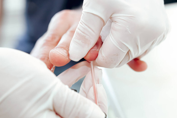 A blood test is a laboratory analysis performed on a blood sample that is usually extracted from a vein in the arm using a hypodermic needle, or via fingerprick. Modern hospital hematology laboratory. - Photo, Image