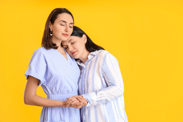 Portrait of adult daughter and her mother on color background - Photo, Image
