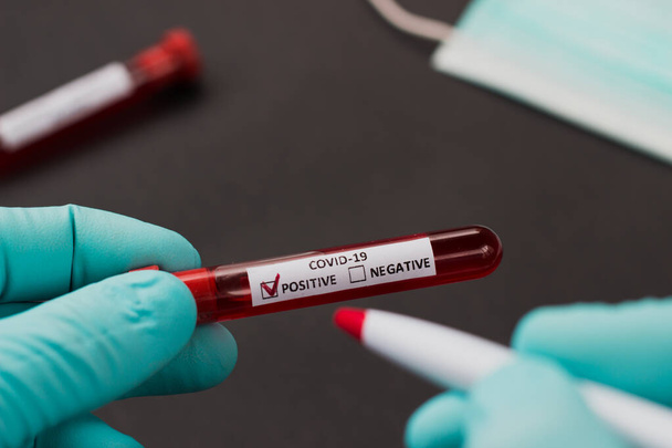 egy vérrel fertőzött kórház kémcsöve, hogy megvizsgálják a vírus koronáját Kínában - Fotó, kép