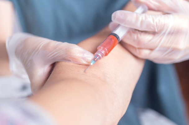 Close up of hands with syringe taking blood test from arm - Fotó, kép